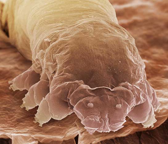  Demodex Mites